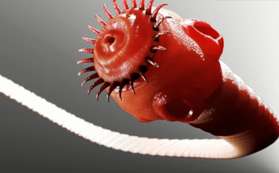parasitärer Wurm aus dem menschlichen Körper