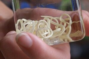 Parasiten aus dem menschlichen Körper