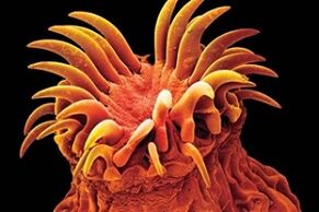 Trematodenparasiten beim Menschen